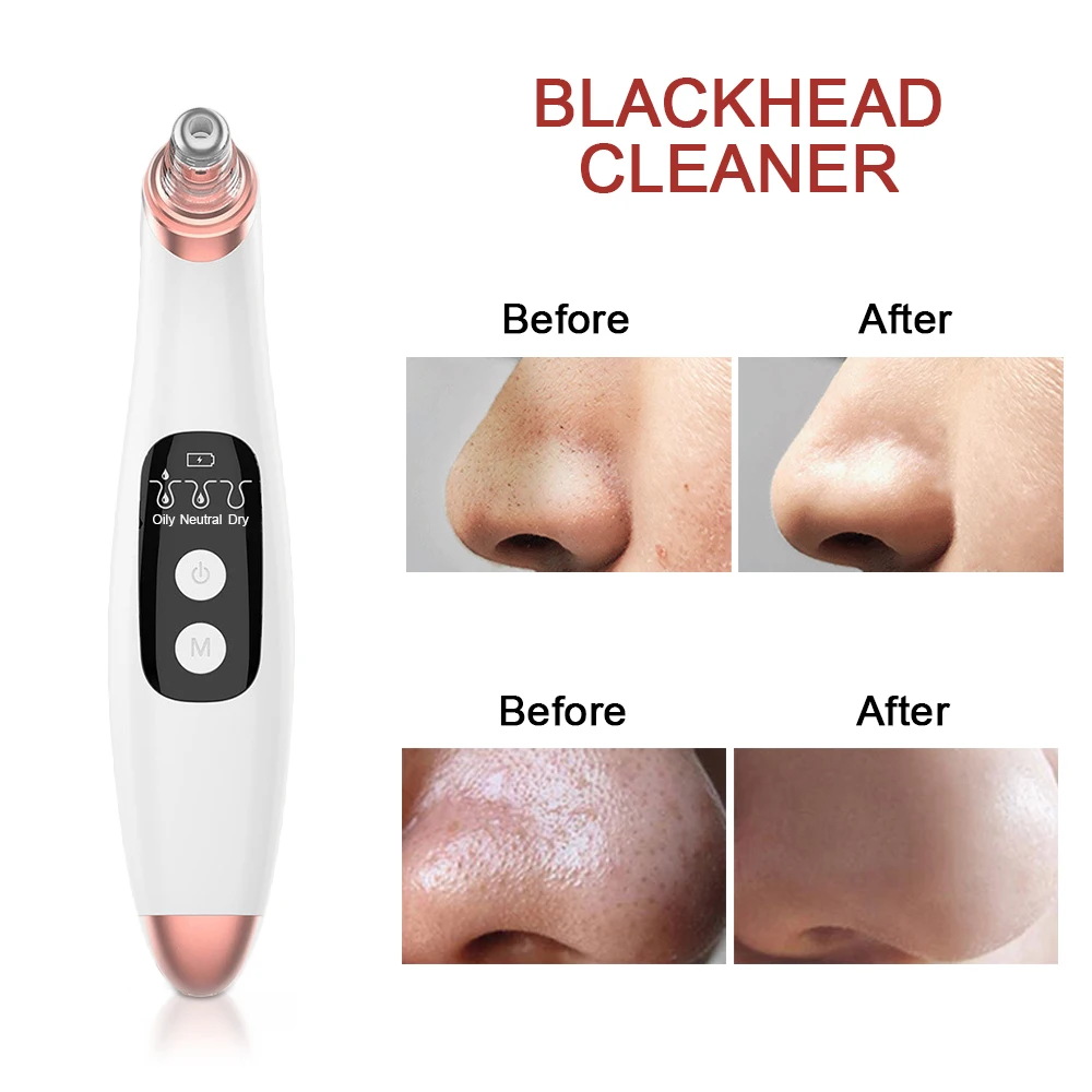 Electric Facial Pore Cleaner Exfoliator Face Blackhead Remover Acne Vacuum Cleansing Suction Machin Nano Sprayer Steamer WA 130