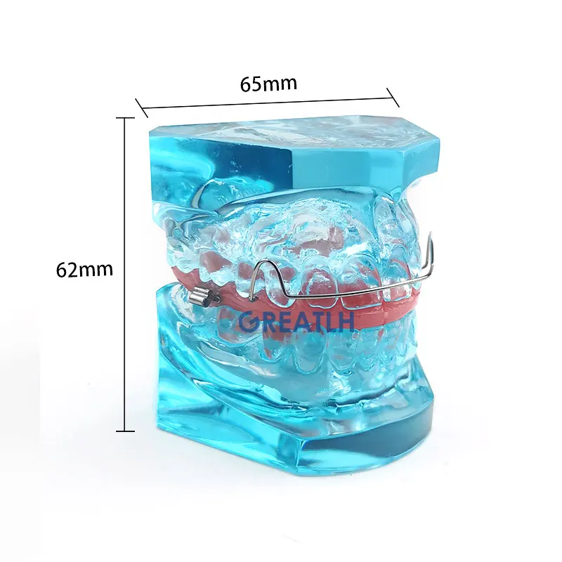 Dental Onderwijs Model Removable Model Orthodontische Model Met Retainer