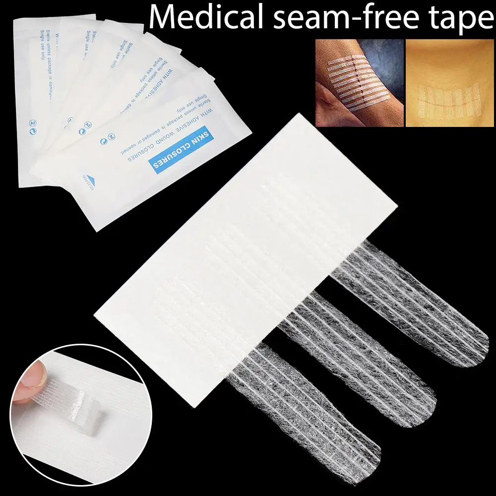 1 Bag 5 Sizes Pull Tight Anti-speed Camping Emergency Skin Wound Strip Beauty Tape Seam-free Sticker Surgery Postpartum