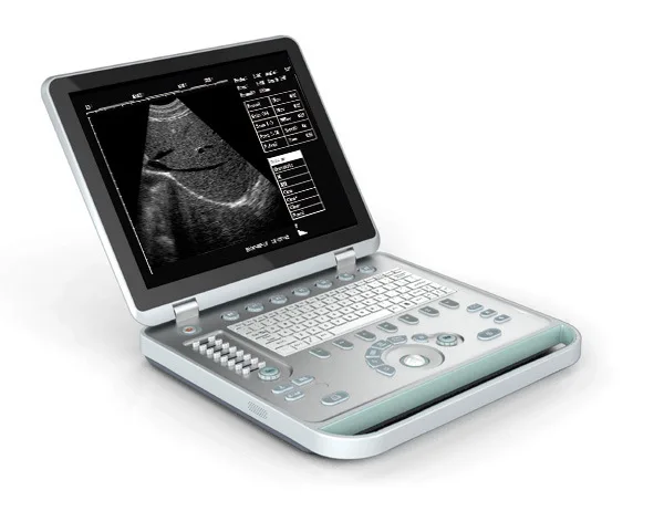 Full digital portable B ultrasound price / medical color B ultrasound / 3D black and white color ultrasound / B ultrasound