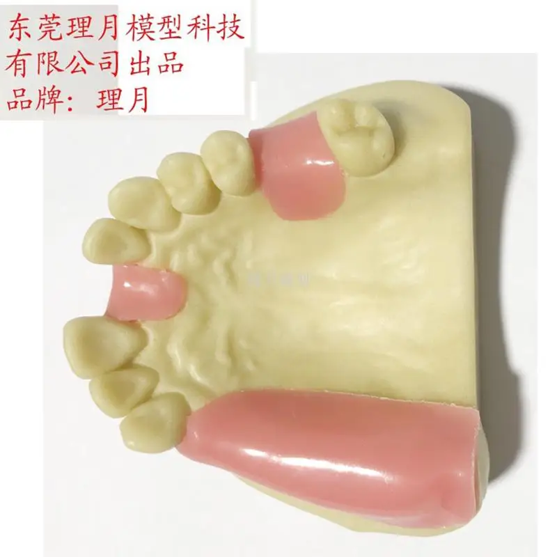 Oral Cavity Dental Implant Teaching Aids Bone Imitating Realistic Antrum Highborn Dental Implants Models Lifelike Teeth Model