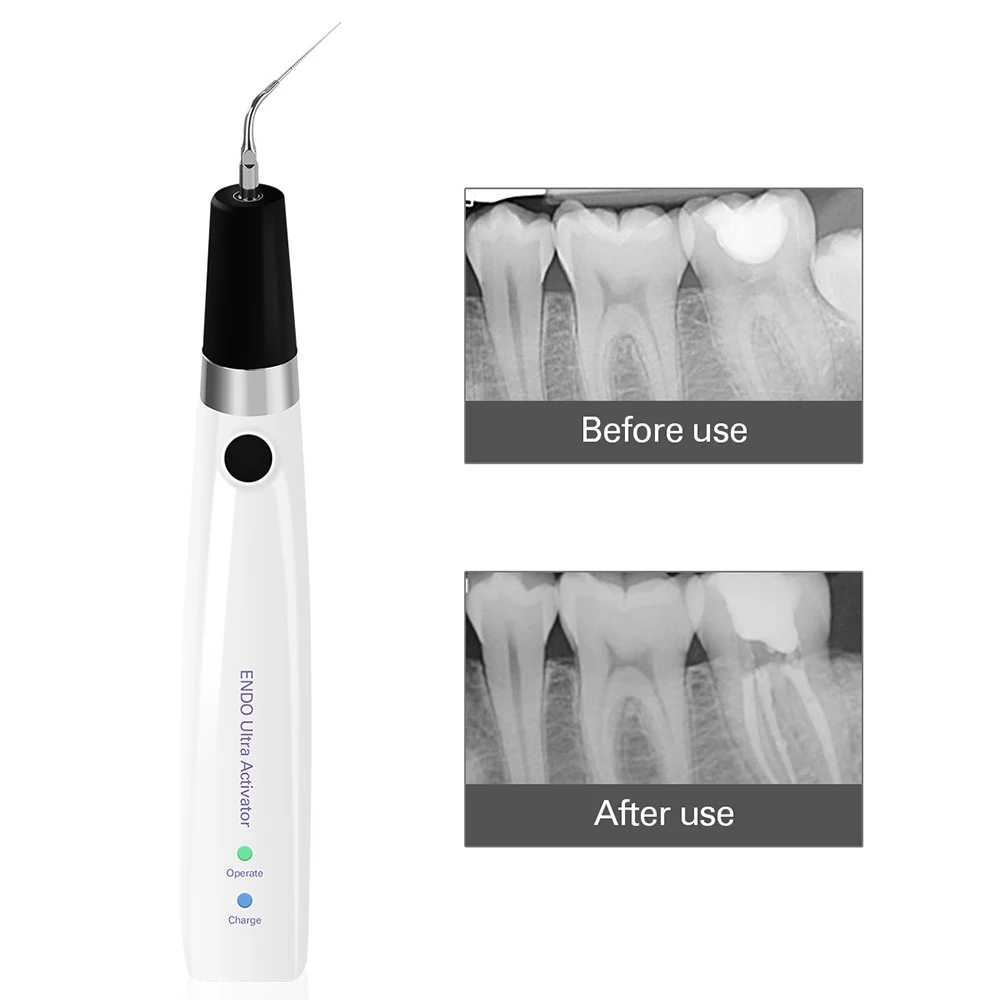 AZDENT Dental Endo Ultrasonic Activator 6 Tips Cordless Endodontic Irrigator Handpiece Root Canal Treatment Dentistry Instrument