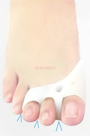 Thumb valgus orthosis hallux valgus toe valgus big bone correction with toe day and night, silicone aligner