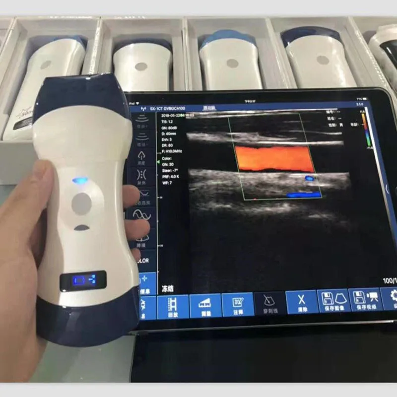 128 elements PW color wireless veterinary ultrasound convex and linear probe double head animal pregnancy