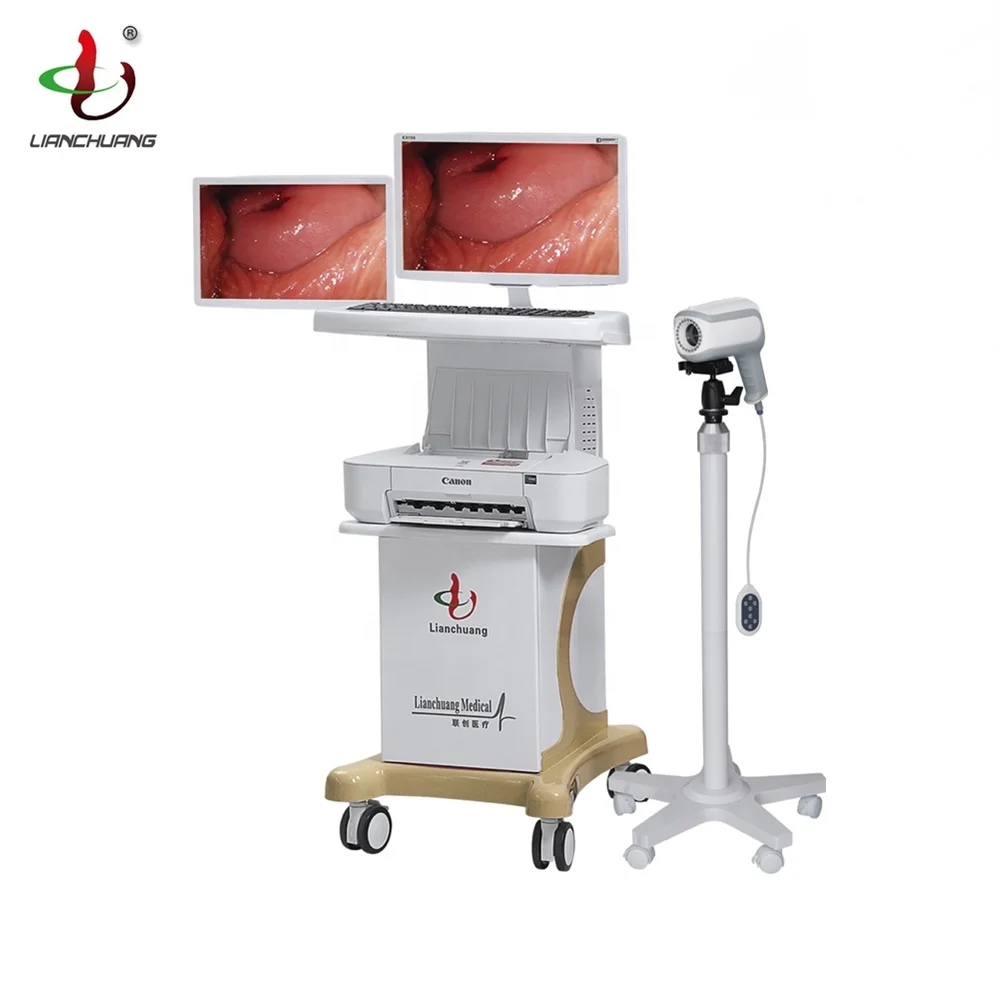 China manufacturers medical video colposcope portable machines portable digital colposcope for gynecology