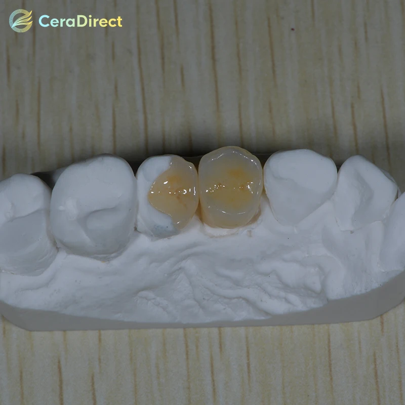 5 Pieces Ceradirect Lithium Disilicate Blocks(Glass Ceramic)-C14-HT/LT ——for Dental Lab CAD/CAM