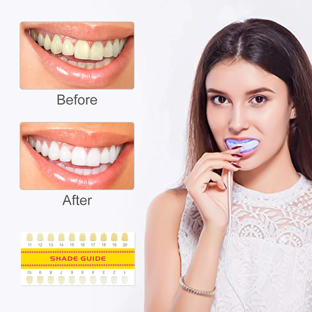 

Luxsmile Home Use Dental Peroxide Teeth Whitening Kit Tooth Bleaching Pen Gel Brightening Kits Teeth Whitening Device Equipment