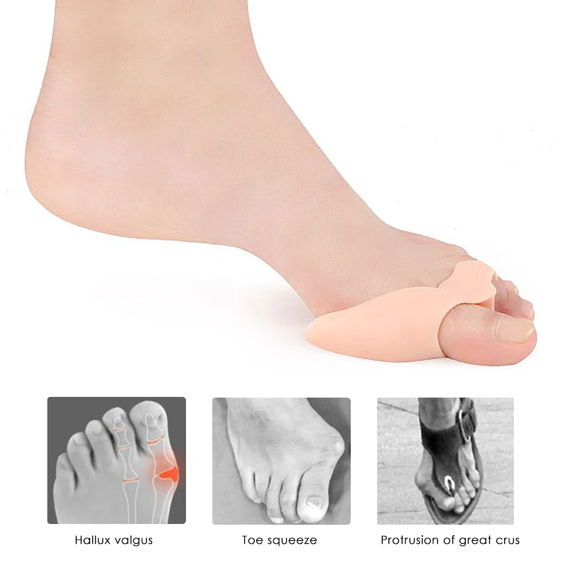 2Pcs Silicone Big Toe Separator Bunion Adjuster Hallux Valgus Toe Straightener Corrector Gel Foot Fingers Pedicure Feet Tool