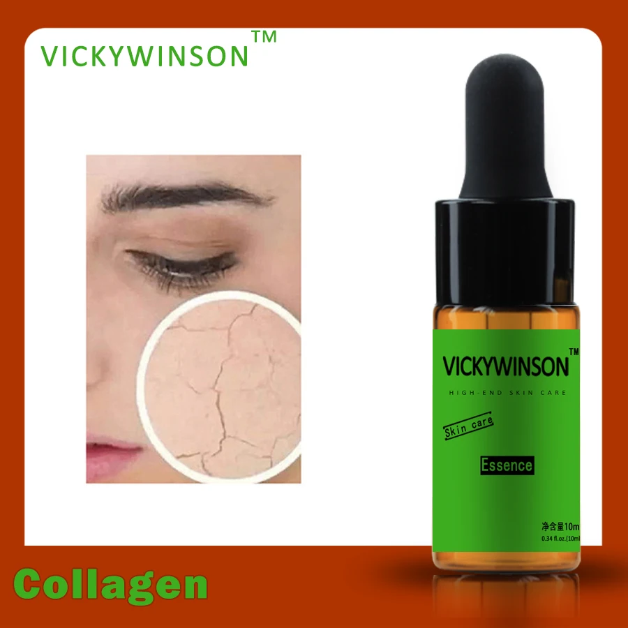 Essência de colágeno soro facial 10ml, soro facial com essência de arroz branco, acne, tratamento com diminuição de poros, hidratante e clareamento