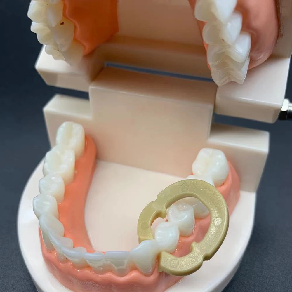 Tandheelkundige hars klemring Scheidingsring Sectionele voorgevormde metalen matrices Matrix Matrix
