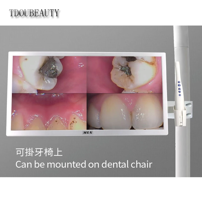 Design M-968 2-in-1 LED Intraoral Camera Dental WIFI Endoscope Oral Exam Camera for Dentists And Dental Clinics