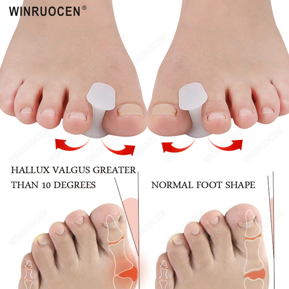 2Pcs Silicone Foot Finger Toe Separator Adjuster Hallux Valgus Pedicure Corrector Feet Care Bunion Bone Thumb Valgus Protector