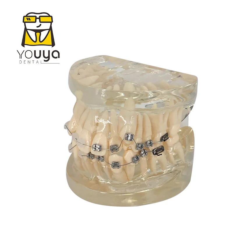 Dental Model With Braces Dentistry Materials Orthodontic Models Gum Tooth Teeth Model For Studying Teaching Patient Education