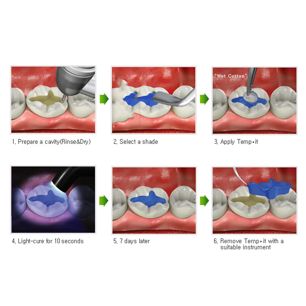 Dental Temporary Resin Light Cure Composite Inlay Outlay Temp Filling Material Tooth Cavity Abutment Sealing Dentistry Supplies