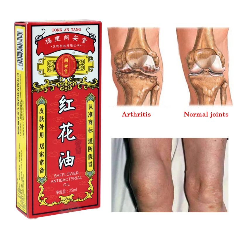 5Pcs/Lot China Saffron Activating Collaterals Oil Rapid Relief From Rheumatic Rheumatoid Arthritis Joint PainMuscle Pain Bruise