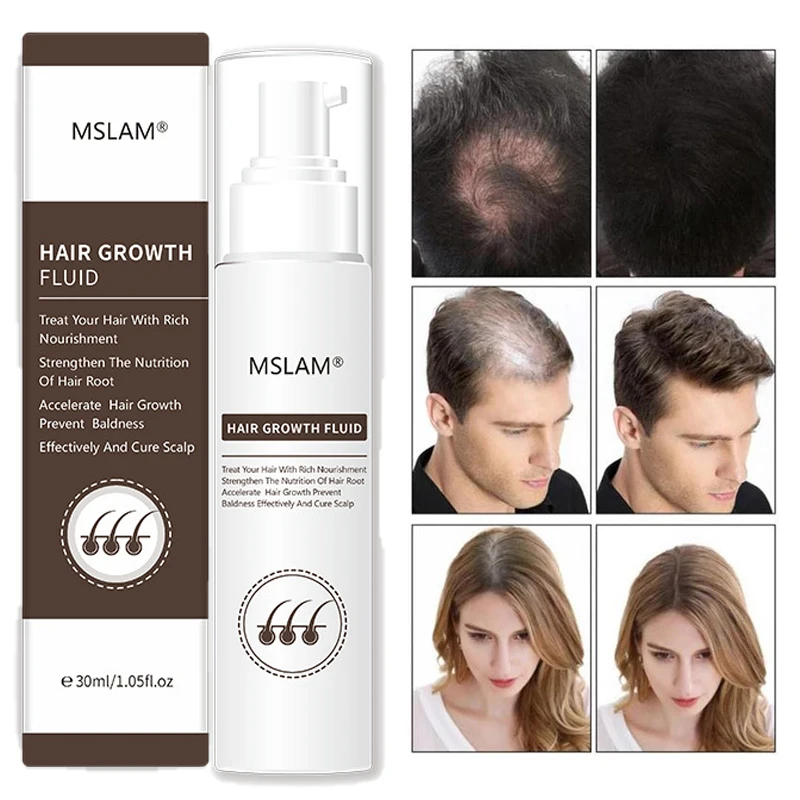 Hair Growth Fluid Hair Growth Spray Rapid Hair Growth Oil Control Antipruritic Prevent Hair Loss Deep Nourishment Repair 30ml