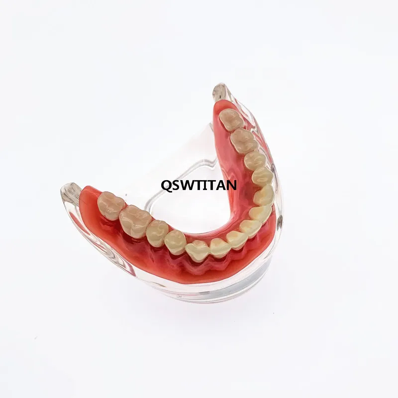 Dental Overdenture Model zębów zdejmowane wnętrze żuchwy z 2 implantami do nauczania zębów