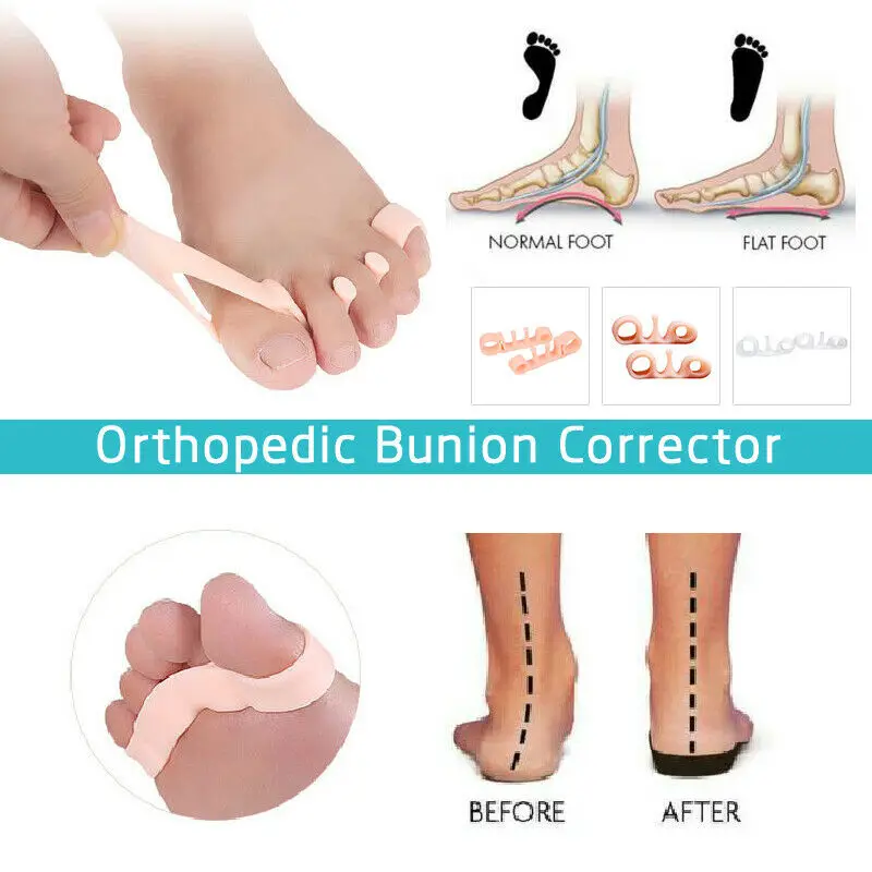 Chaussette de soin des pieds pour Hallux Valgus, pédicure, correcteur orthopédique, oignon, séparateur d\'orteils, redresseur des pieds