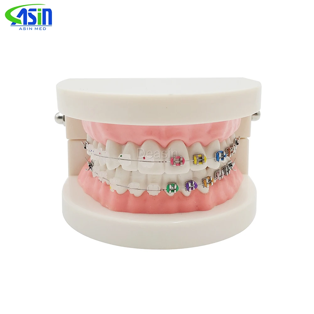 New Orthodontics Model for Dentist Dental 1/2 Standard Dentition with half Metal Brackets half ceramic bracket Teeth Model