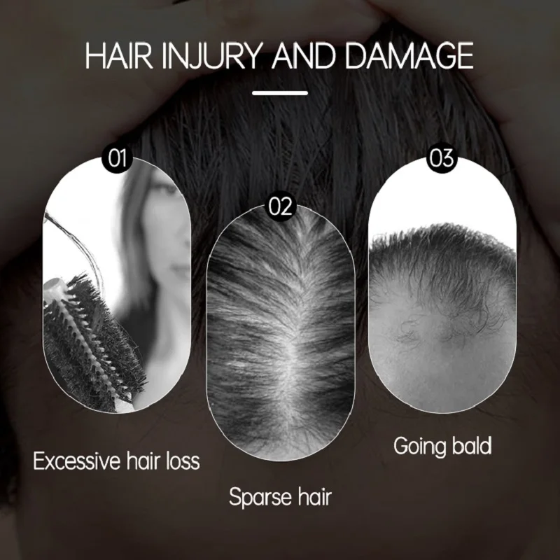 Biotin Hair Growth Products Vitamin Oil Fast Growing Anti Hair Loss Roller Massager Scalp Treatment Fast Grow for Men Women Care