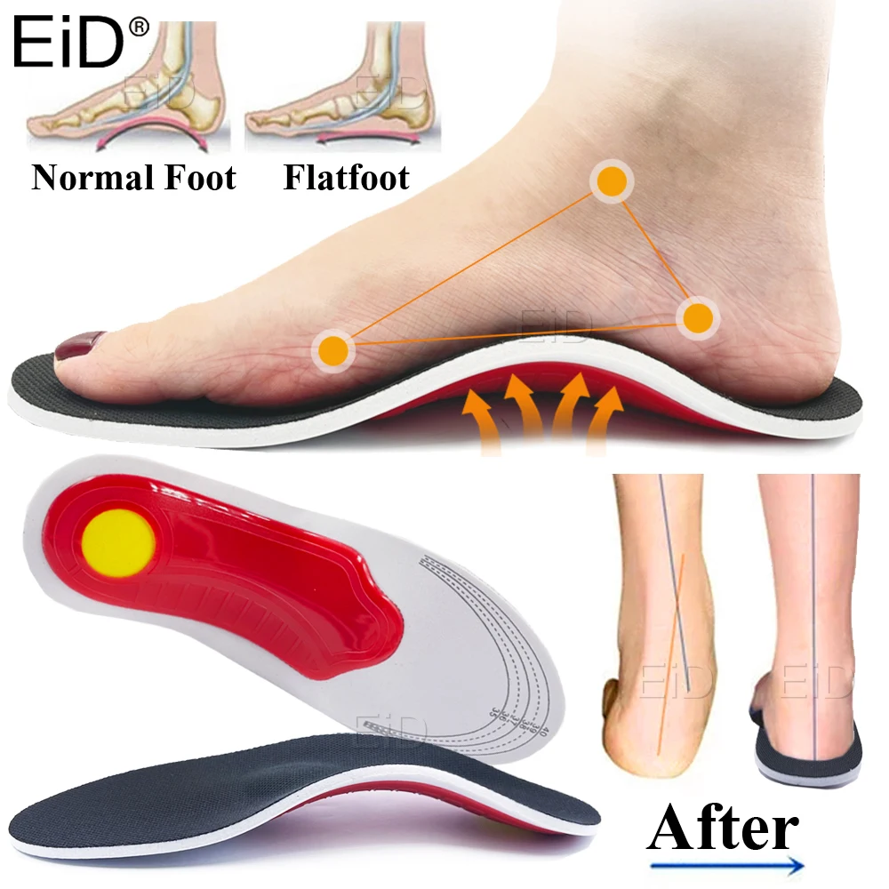 Orthotic Insole arch support Flatfoot Orthopedic Insoles for feet Ease Pressure Of Air Movement Damping Cushion Padding Insole