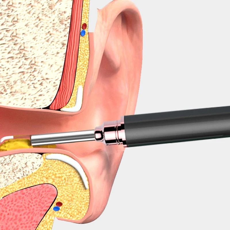 Endoscopio inalámbrico de alta precisión, minicámara de otoscopio, limpiador de oídos, boroscopio, USB, Visual inteligente, 500W