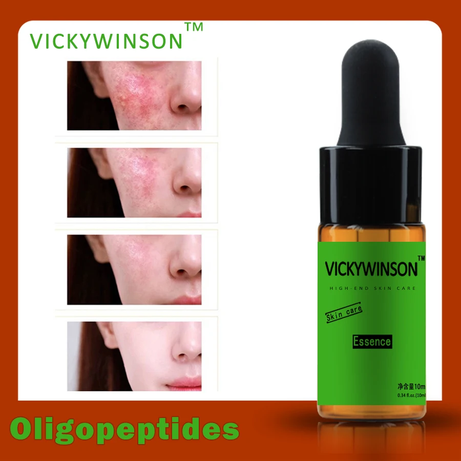 Oligopeptides essence 10ml Face Serum Rejuvenation Hyaluronic Acid Moisturizing Whitening Rejuvenating Serum to maintain supple