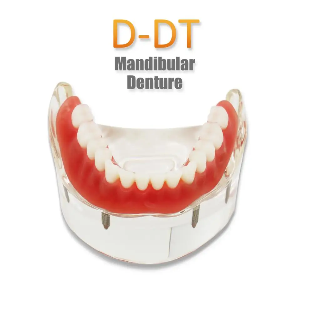 

D-DT(Lower jaw) Dental Study Teaching Model Dental Impant Standard Model Removable Teeth ADULT Child Model Dentist Communicatio