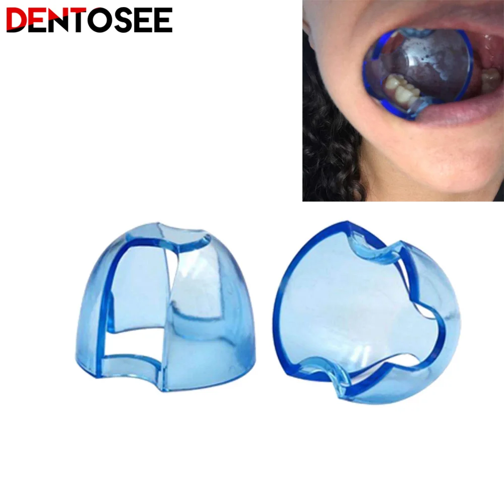 

Dental Intraoral Cheek Retractor Lip Mouth Opener Tooth Whitening for Anterior Posterior Teeth Dental Orthodontic Expander