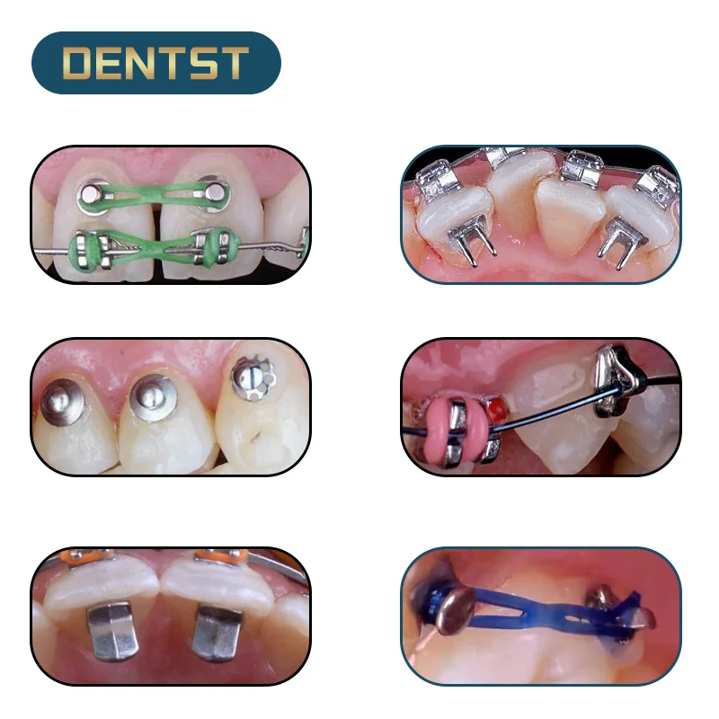 10 sztuk/torba ortodontyczny aparat lingwalny przyciski ceramiczne kompozytowe Dentista trakcji hak język Tamer Bondable zawias zgryz Turbo