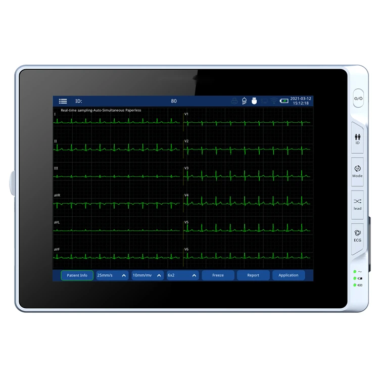 BT-ECG60D medical portable 3 /6/12 Channel Work with PC  More than 1000 data built-in storage ECG EKG Machine