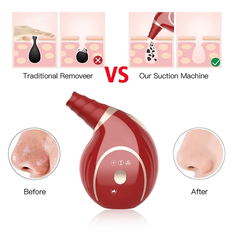 ขนาดเล็ก Conch Blackhead Remover ไฟฟ้าดูดสูญญากาศเครื่องมือผิวหน้าสิวจุดด่างดำ Pore สิวสิวทำความสะอาดเครื่อง