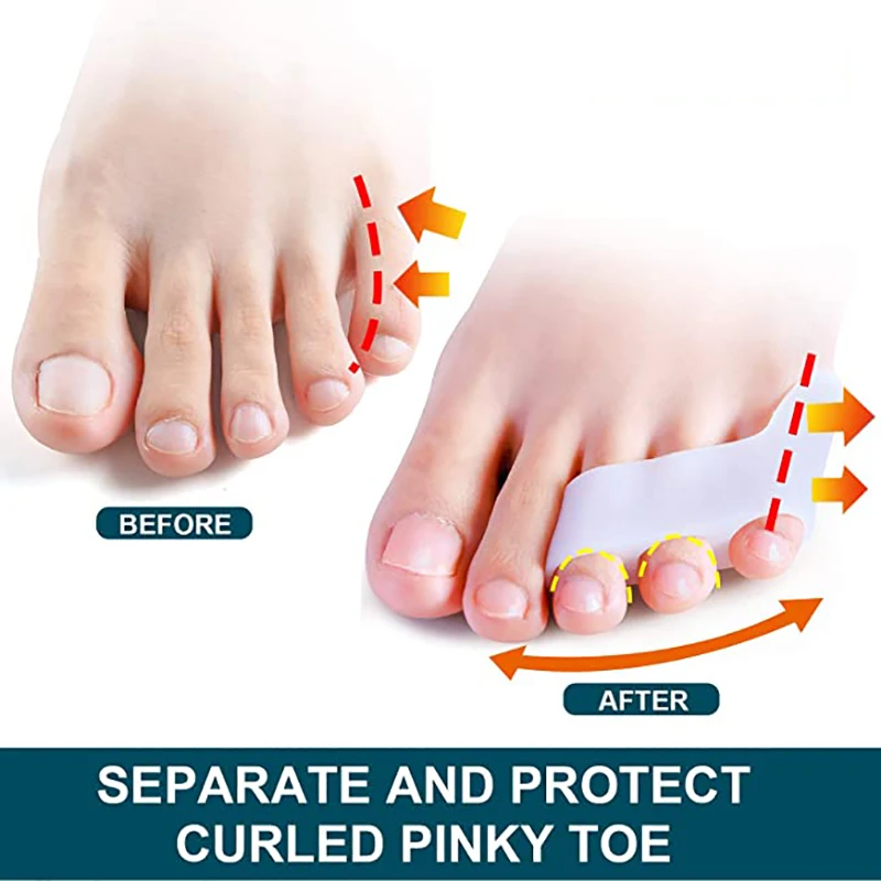 Bộ 2 Gel Silicone Ít Ngón Chân Chia Chồng Chéo Ngón Chân Máy Duỗi Bunion Vỉ Giảm Đau Ngón Chân Bảo Vệ Chăm Sóc Chân Dụng Cụ