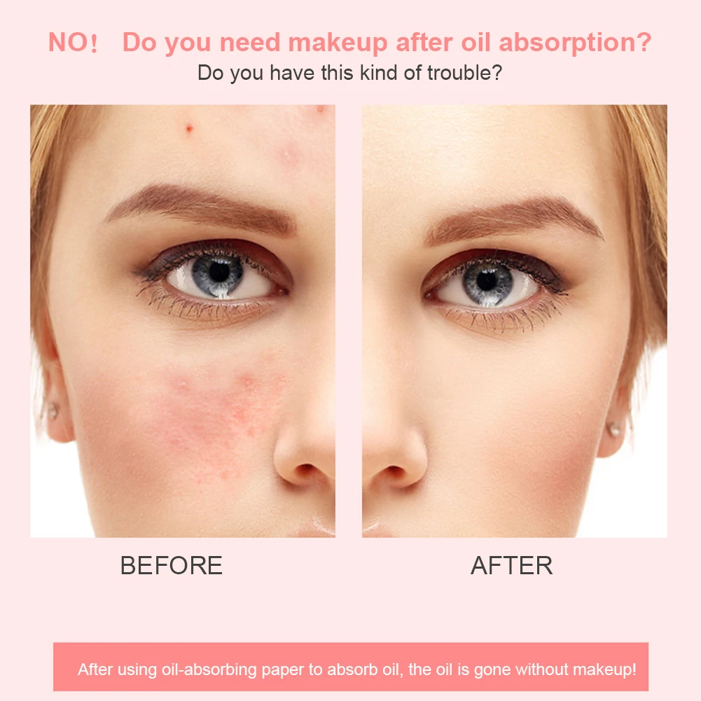 Strumenti per la cura della pelle artiglio di gatto pietra vulcanica rullo assorbente dell'olio viso t-zone rimozione dell'olio palla rimozione di punti neri Acne rimuovi trucco