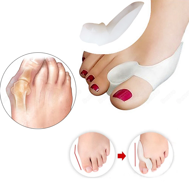 Separador de dedos del pie de silicona, férula de juanete, Corrector superpuesto de hueso, Hallux Valgus, inserto de zapato, herramientas de ortesis para el cuidado de los pies, 1 par