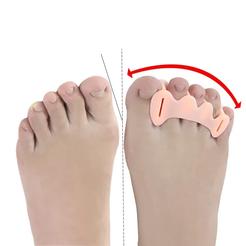 2Pcs=1Pair Hard Silicone Toe Separator Correction Hallux Valgus Corrector Orthopedic Hammer Separator Straightener Foot Care