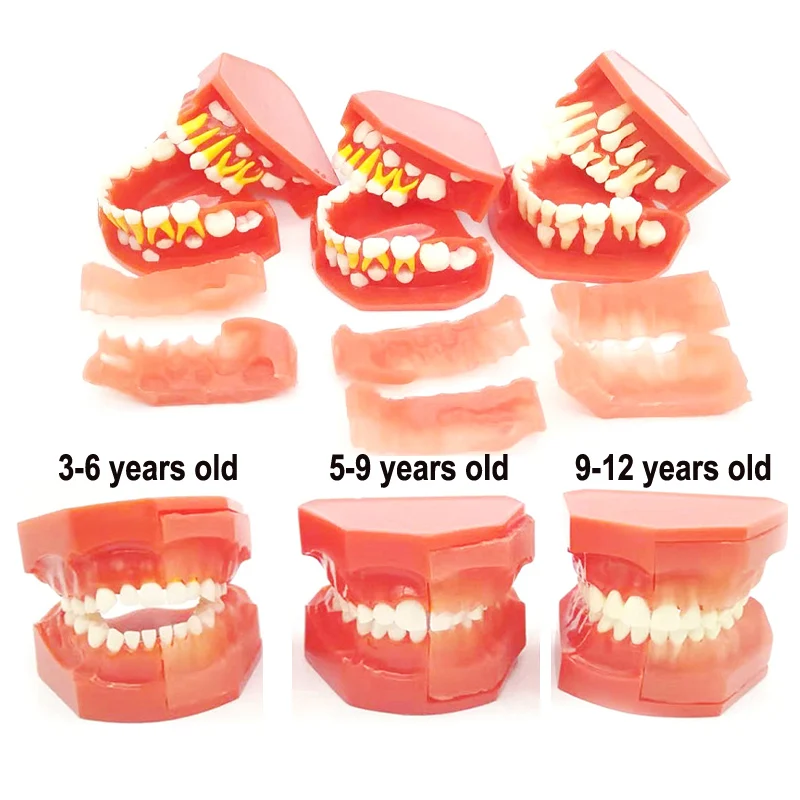 

Dental Oral Teaching Model Children's Primary And Permanent Teeth Alternate Model Deciduous Teeth Replacement Teeth Development