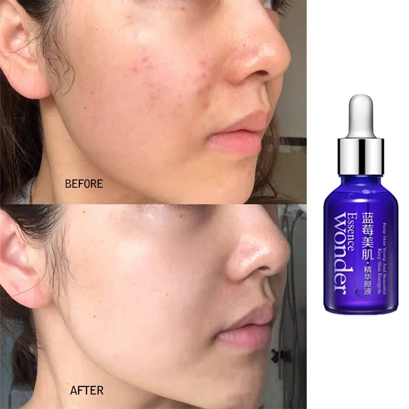 BIOAQUA Blueberry Face Lifting Serum Anti Aging Wonder Essence Skin Care Anti Wrinkle Serum Of Youth Organic Cosmetic Charm