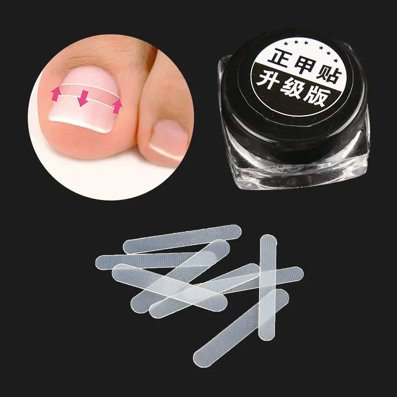 Outil de Correction des ongles incarnés, 10 pièces, Patch élastique de traitement des ongles incarnés, Clip de redressement, outil de pédicure