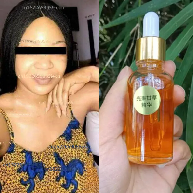 

30ML Authentic Strong Whitening Serum for Dark Skin Lightening Lotion for Dark Knuckles, Elbows, Fingers and Inner Thighs