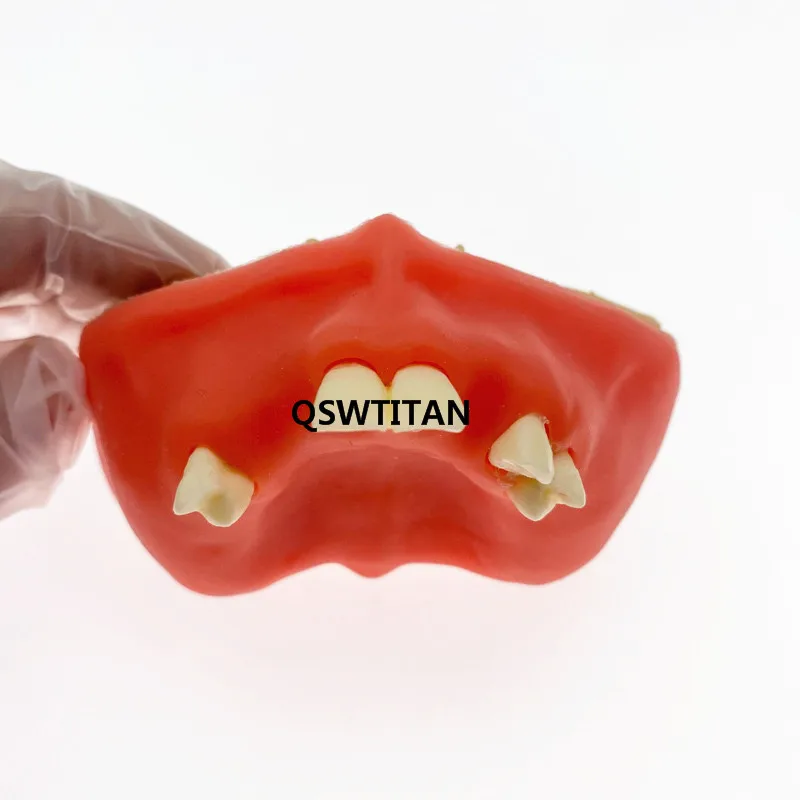 Dental Sinus Lift Practice Teeth Model Typodont Study Model Demonstration teaching tooth model