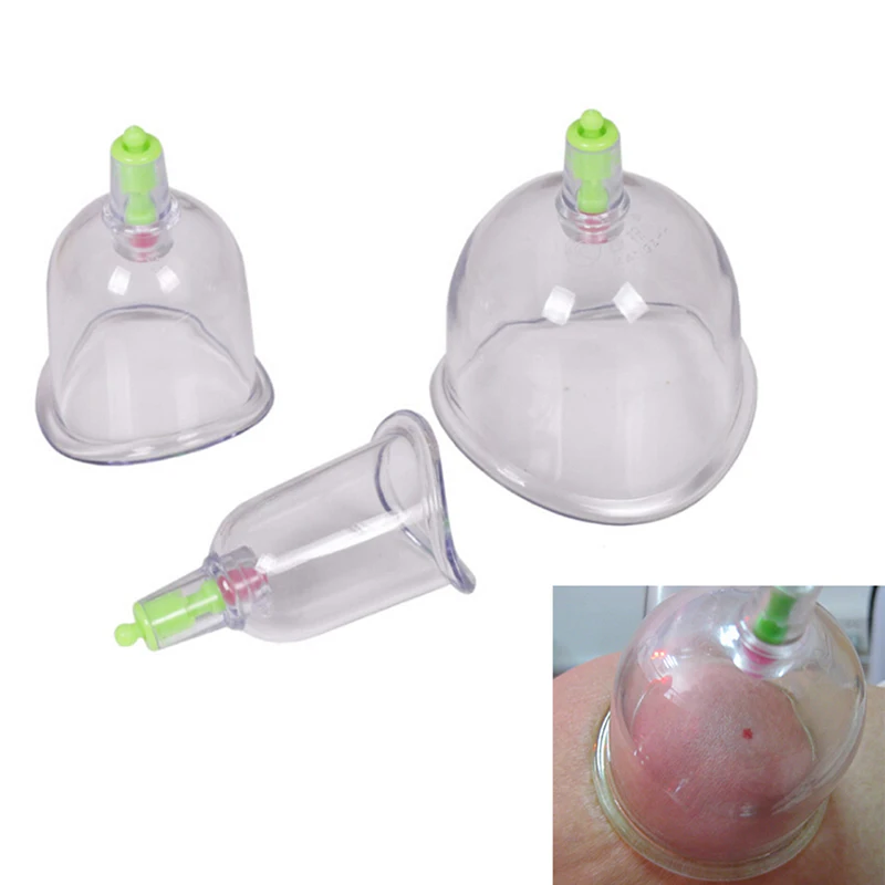 3 Pcs Curved Vacuum C1 Cups Cupping For Joint Suction Chinese Massage Traditional