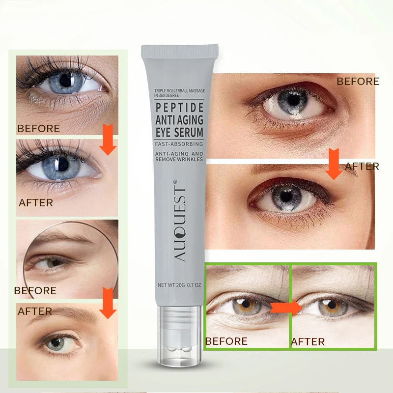 Anti Aging Serum Cream Anti-Wrinkle Collagen Remove Dark Circles Eye Cream Against Puffiness Eye Care tool