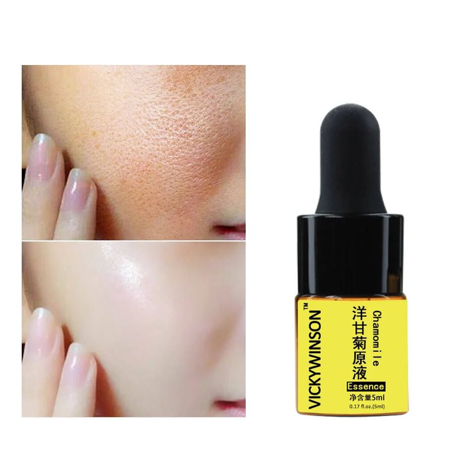 Chamomile essence 5ml Face Moisturizing Cream Anti Wrinkle Anti Aging Face Fine Lines Acne Skin Care Essence