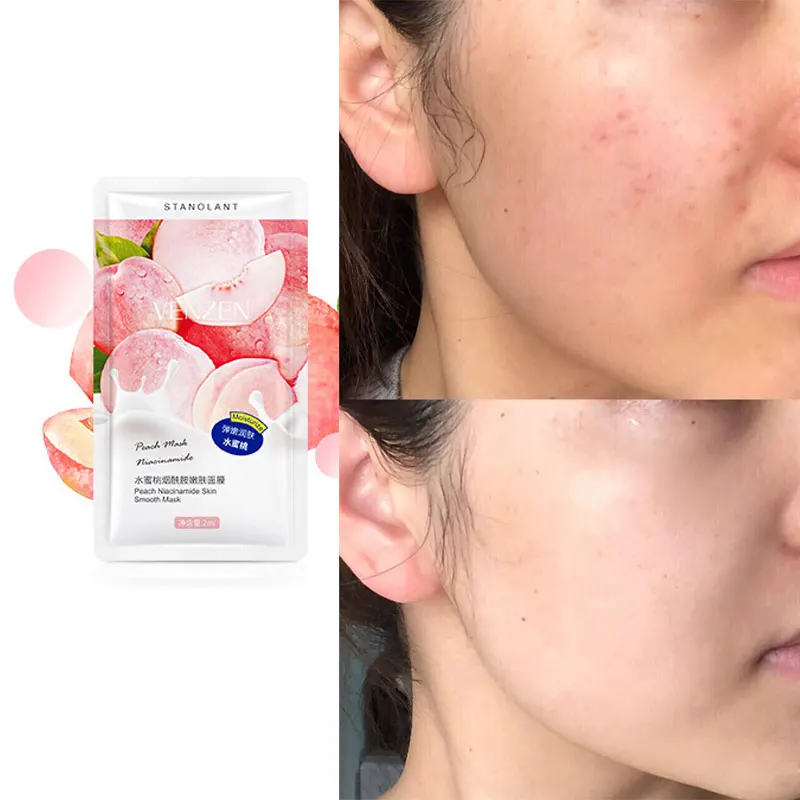 Máscara de niacinamida melocotón para dormir, mascarilla Facial hidratante desechable para cepillar los poros, reafirmante y brillante para la piel,