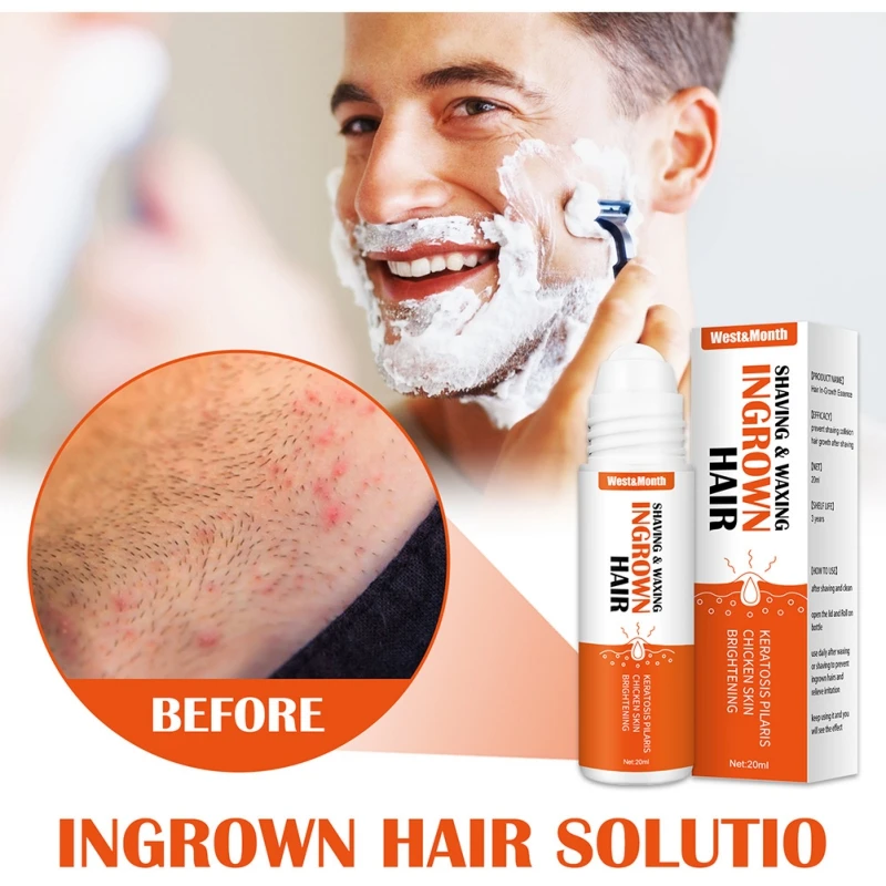 20ml After Shave Repair Serum Solution Soothes And Moisturizes for Ingrown Hair Skin Care