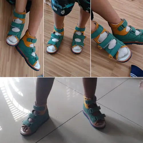 Ortoluckland Children Sandals Summer Boys Baby Orthopedic Shoes For Kids Toddler Teenager Fashion Flatfoot Footwear 2 Years Old - Image 5