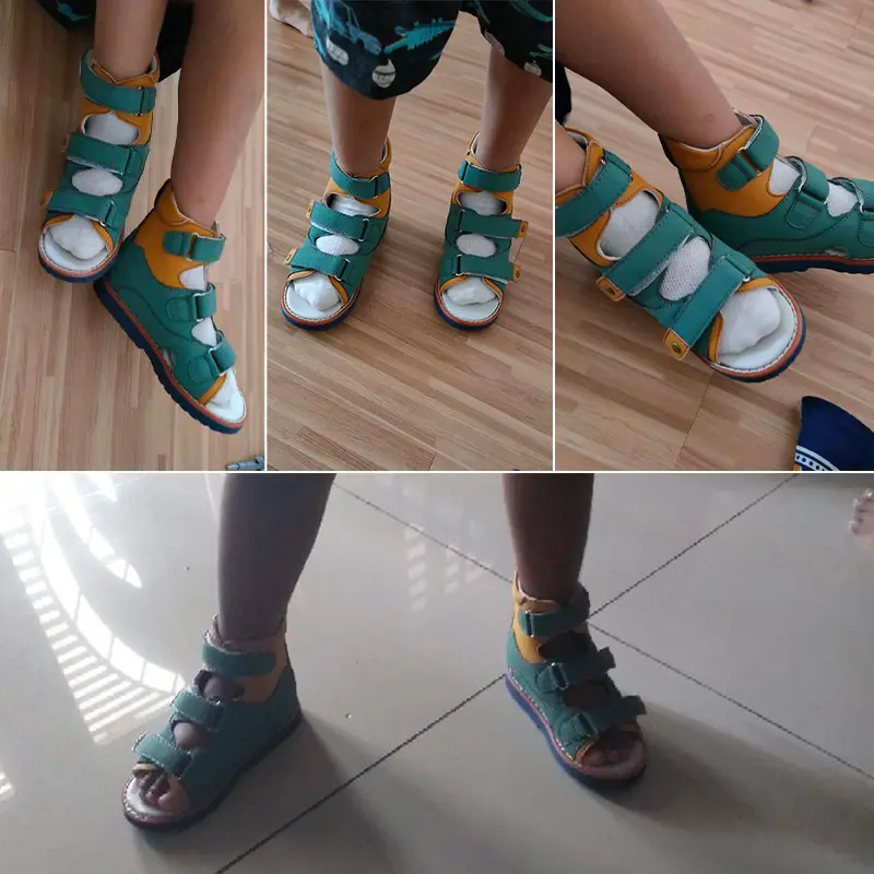 Ortoluckland Children Sandals Summer Boys Baby Orthopedic Shoes For Kids Toddler Teenager Fashion Flatfoot Footwear 2 Years Old - Image 5