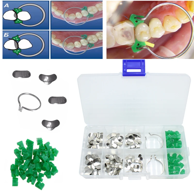 100Pcs/box Dental Sectional Contoured Matrices Matrix Ring Delta Wedges