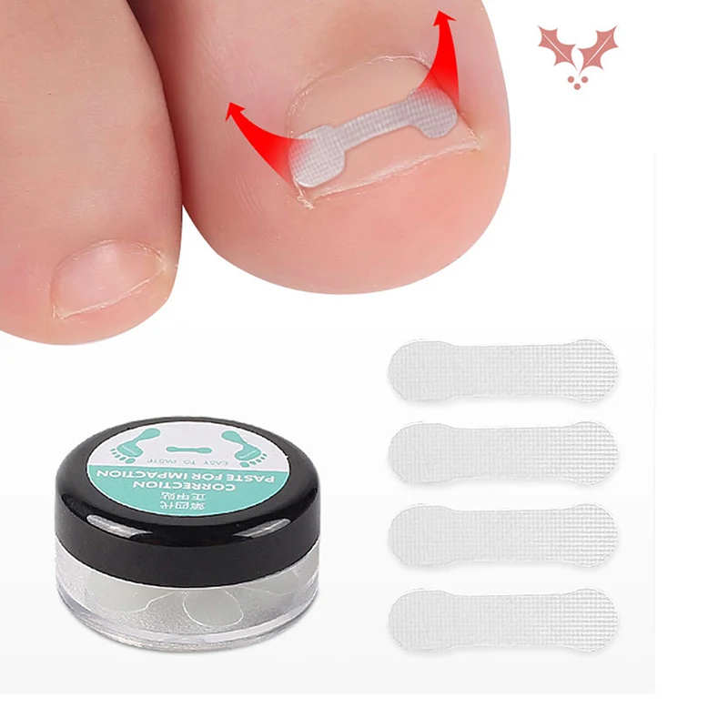 Ingrown Toe-Tratamiento de uñas, herramienta de corrección de las uñas encarnadas, parche elástico, pegatina, alisado, Clip, abrazadera, herramientas de pedicura, 10 Uds.